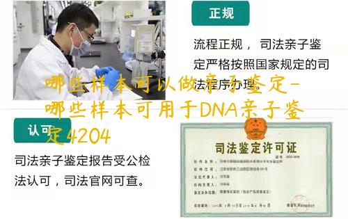 哪些样本可以做亲子鉴定-哪些样本可用于DNA亲子鉴定4204